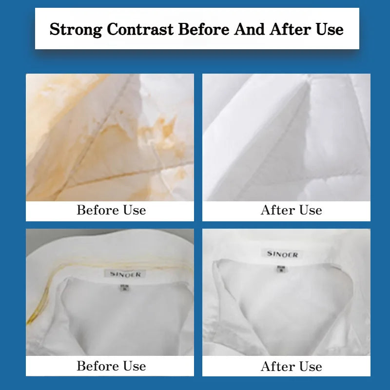 Fabric Stain Remover Spray Dust Bleached Decontamination Treater Spray Effective Yellow Stains Removal for Laundry and Shoes